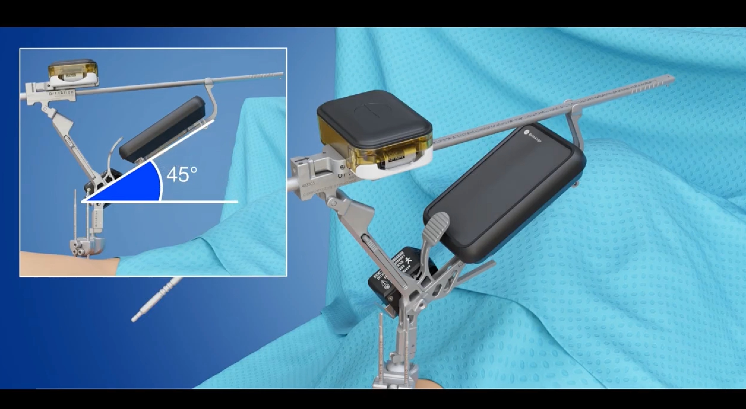 Lantern Hip - sawbones workflow - lateral