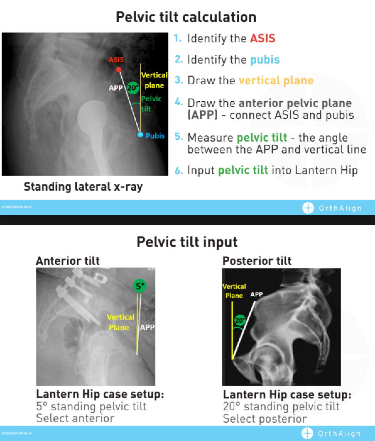 Pelvic Tilt Wallet Card